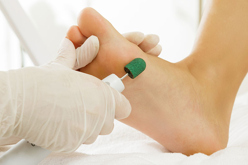 diabetes podiatry foot care