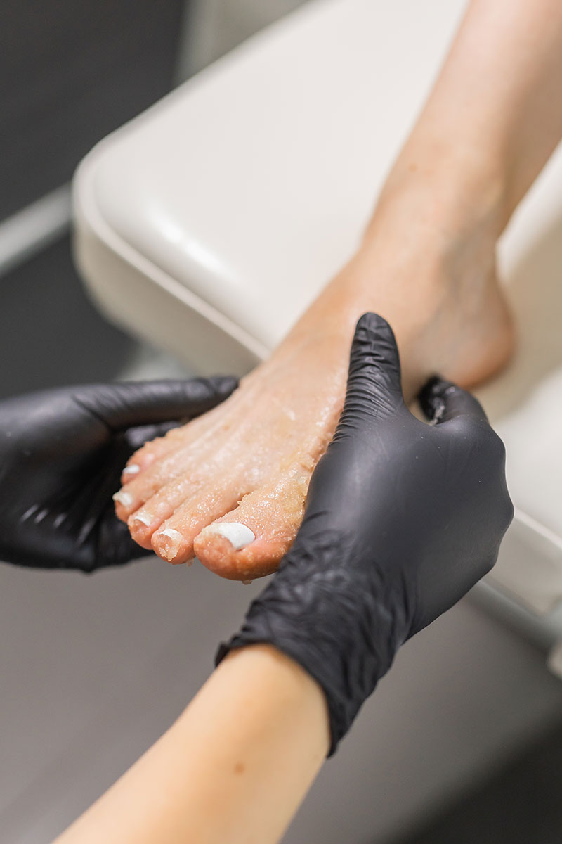 corn removal podiatry